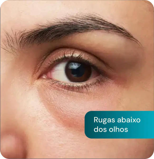 Frame 19