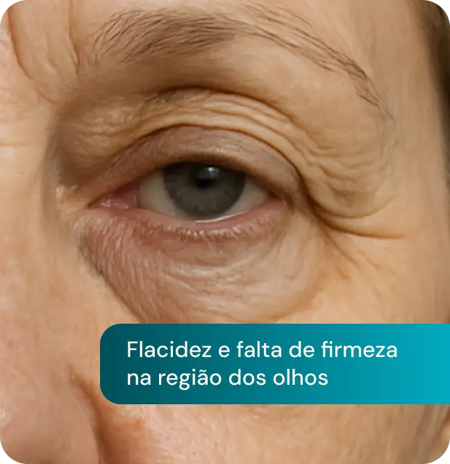 Frame 22